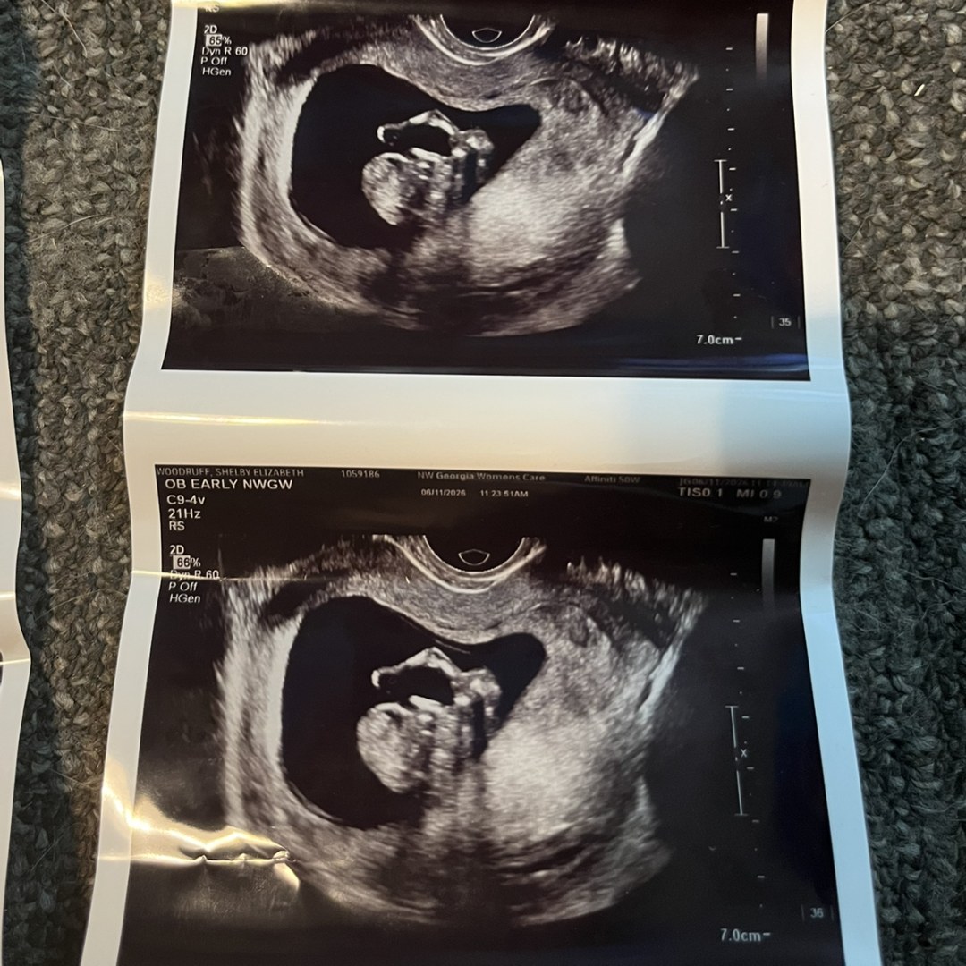 Photo shared by Shelby for their Babylist baby registry.