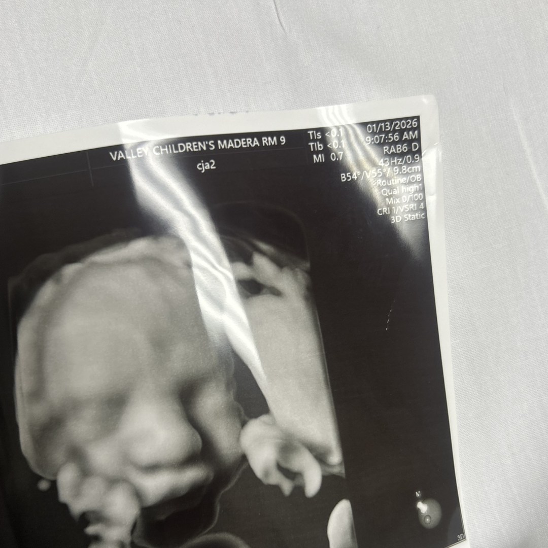 Photo shared by Olivia for their Babylist baby registry.