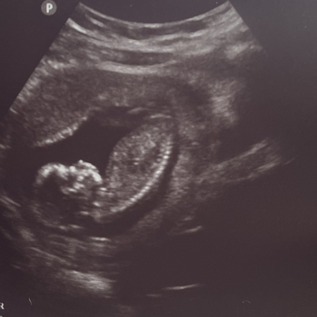 Photo shared by Cecilia for their Babylist baby registry.