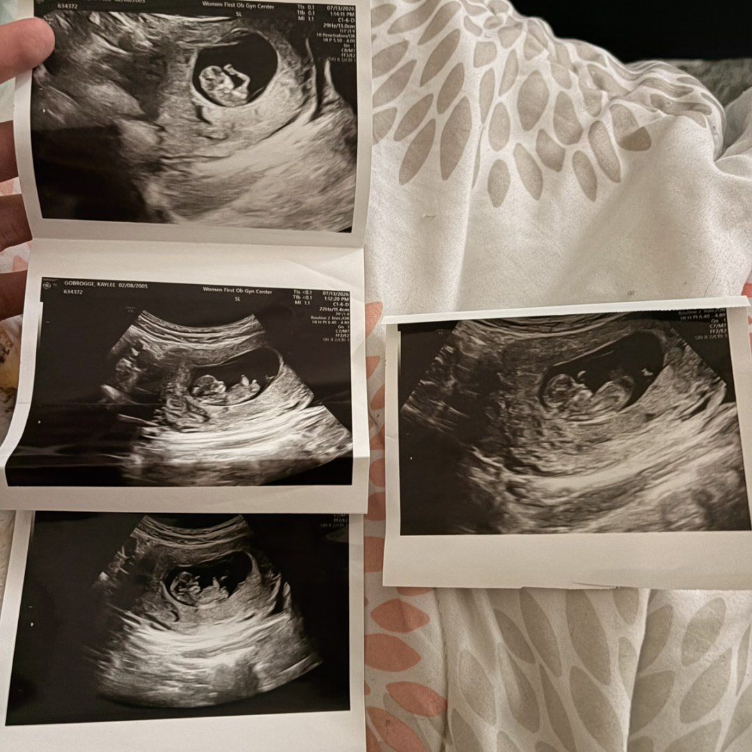 Photo shared by Kaylee for their Babylist baby registry.