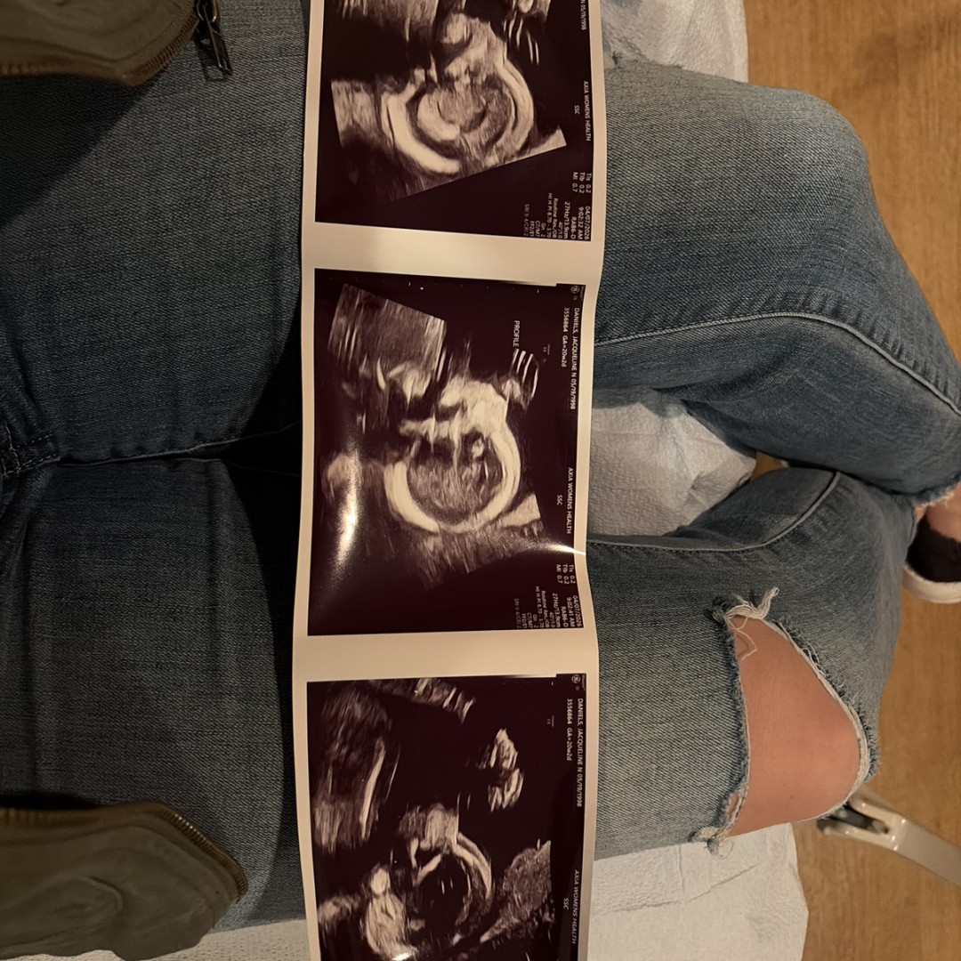 Photo shared by Jacqueline for their Babylist baby registry.