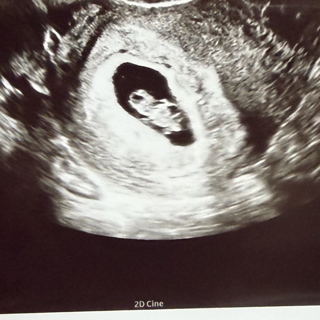 Photo shared by Allison for their Babylist baby registry.