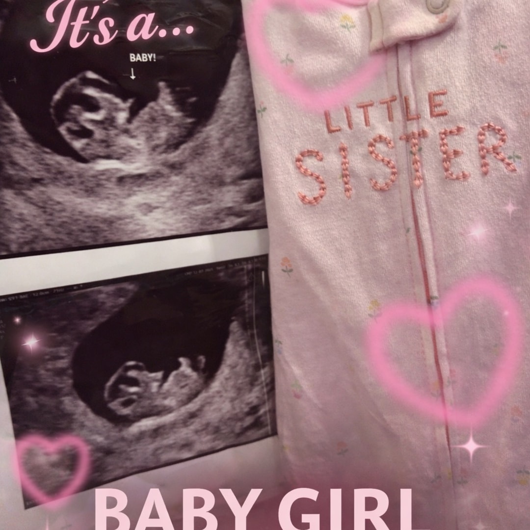 Photo shared by Abby for their Babylist baby registry.