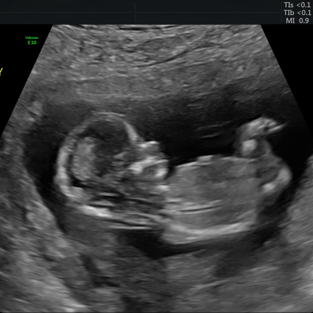 Photo shared by Emily for their Babylist baby registry.