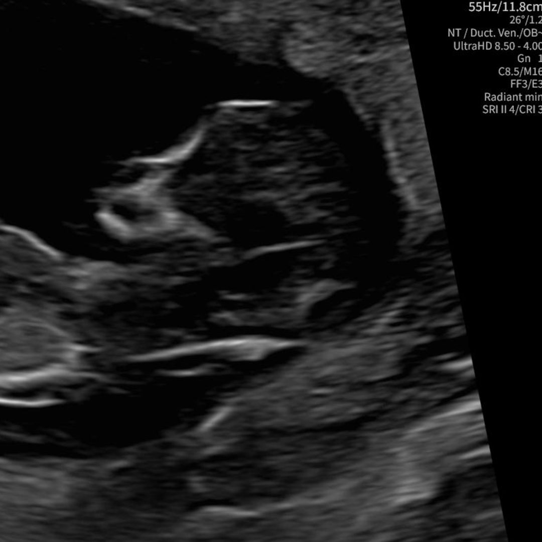 Photo shared by Jonathan for their Babylist baby registry.