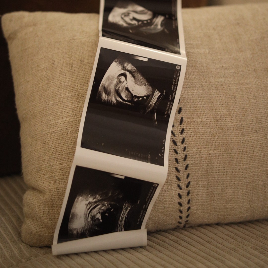 Photo shared by Garrett & Haley for their Babylist baby registry.