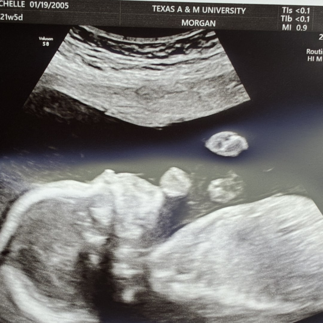 Photo shared by Michelle for their Babylist baby registry.