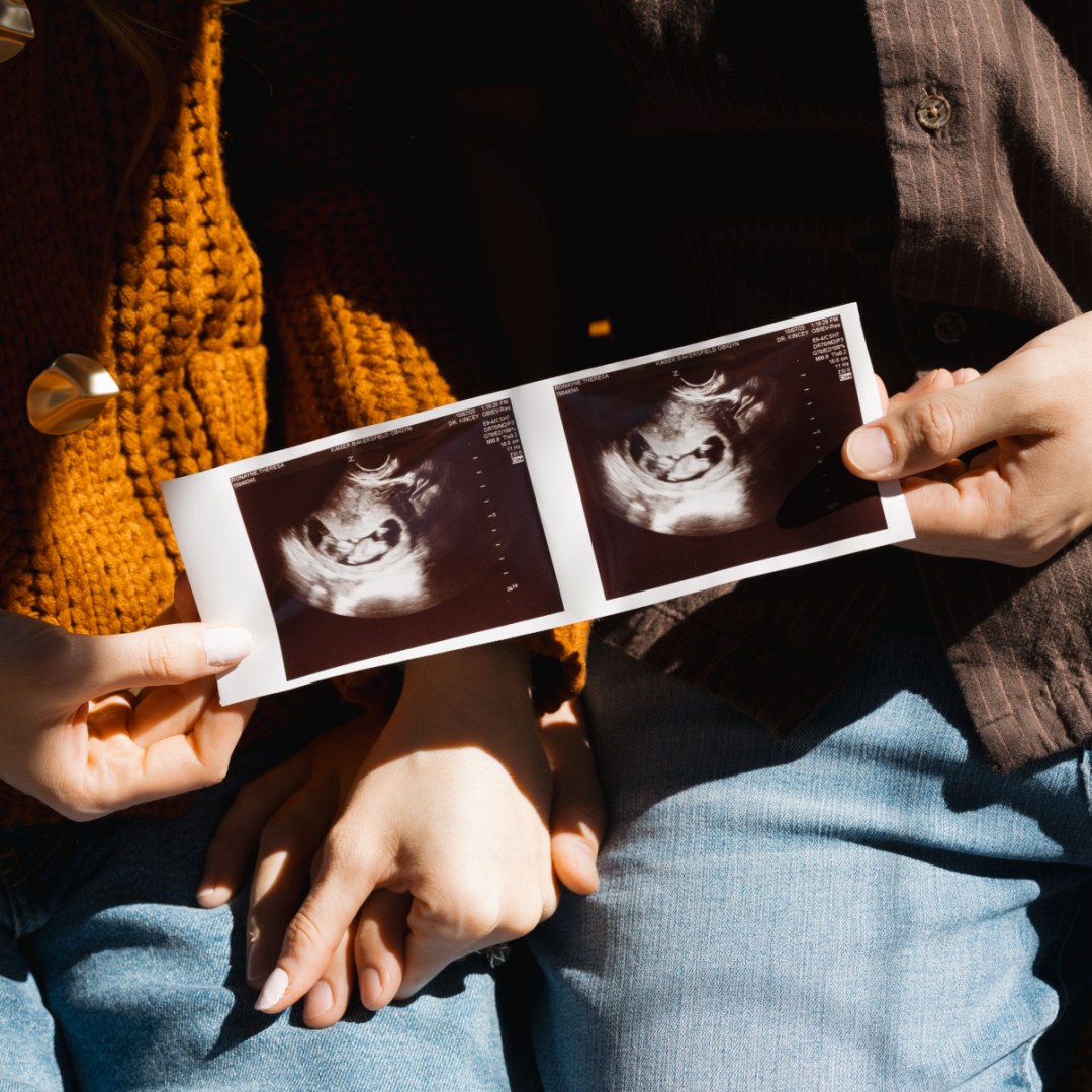 Photo shared by Theresa for their Babylist baby registry.