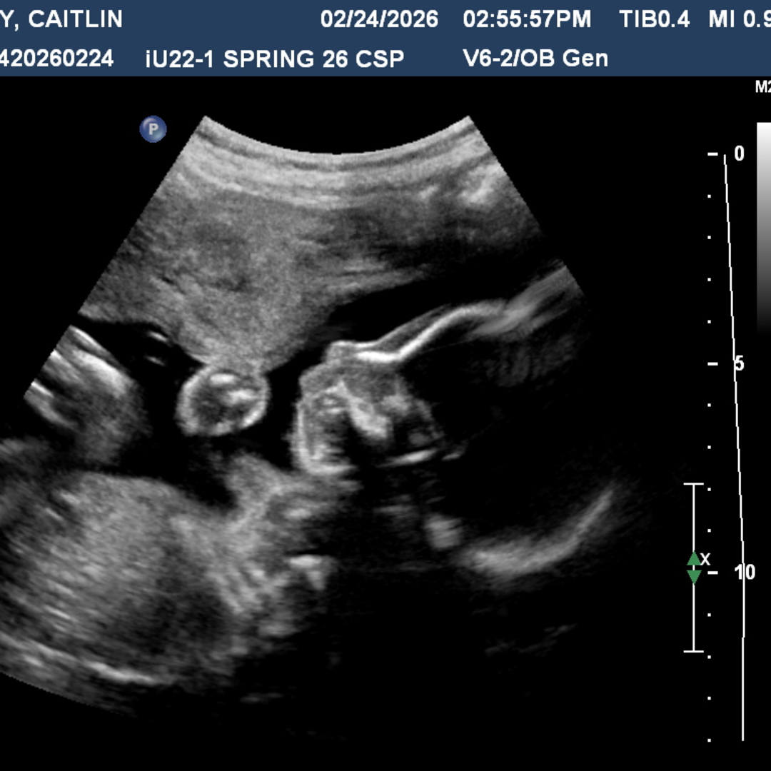 Photo shared by Caitlin for their Babylist baby registry.