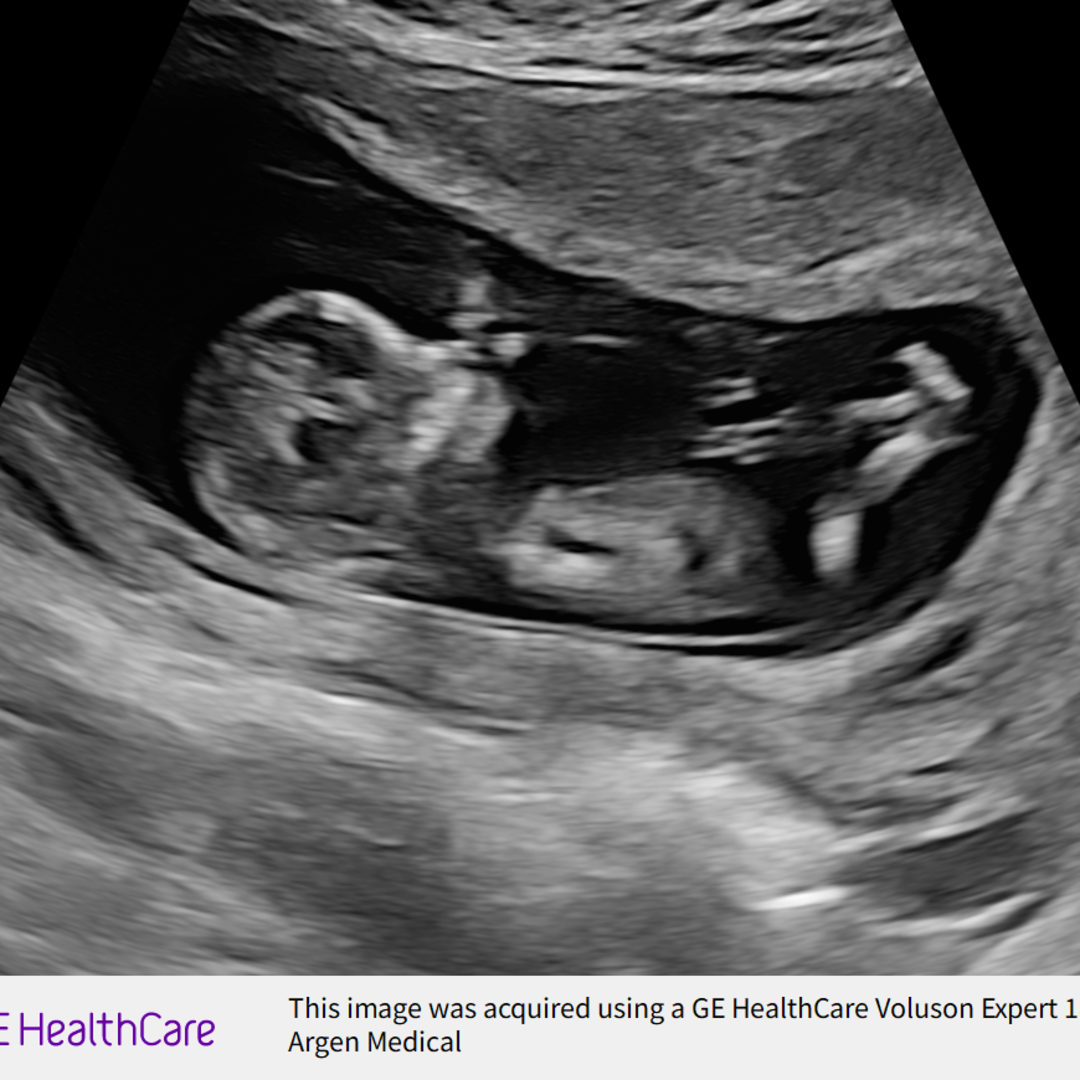 Photo shared by Camille for their Babylist baby registry.