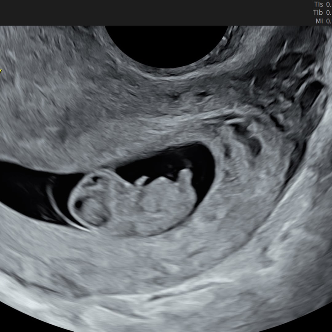 Photo shared by Ava for their Babylist baby registry.
