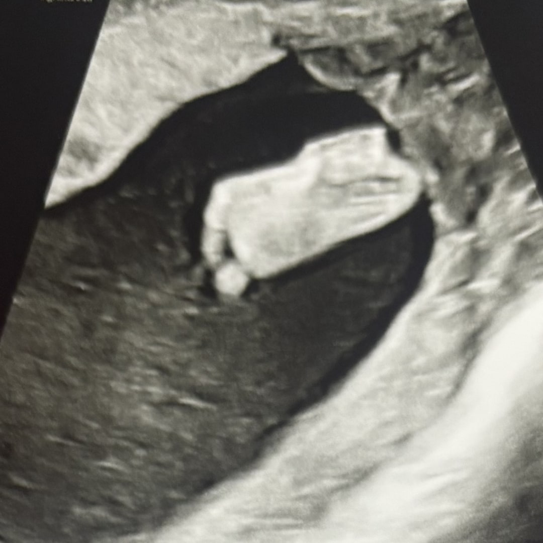 Photo shared by Samantha for their Babylist baby registry.