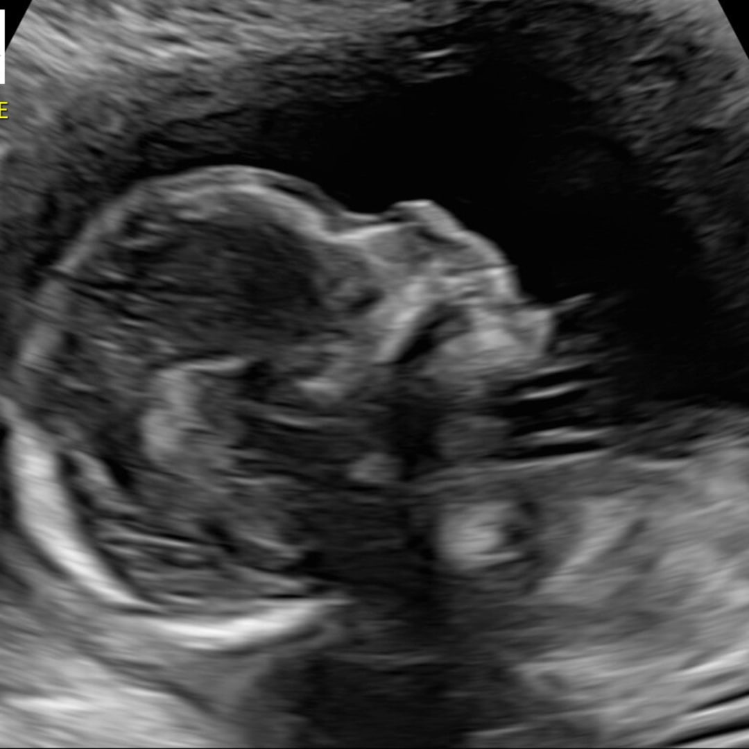 Photo shared by Ashley for their Babylist baby registry.