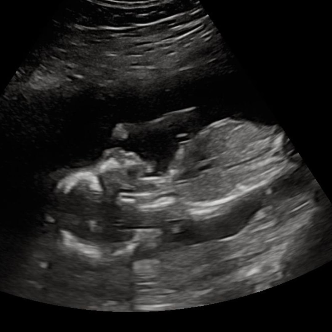 Photo shared by Emily for their Babylist baby registry.