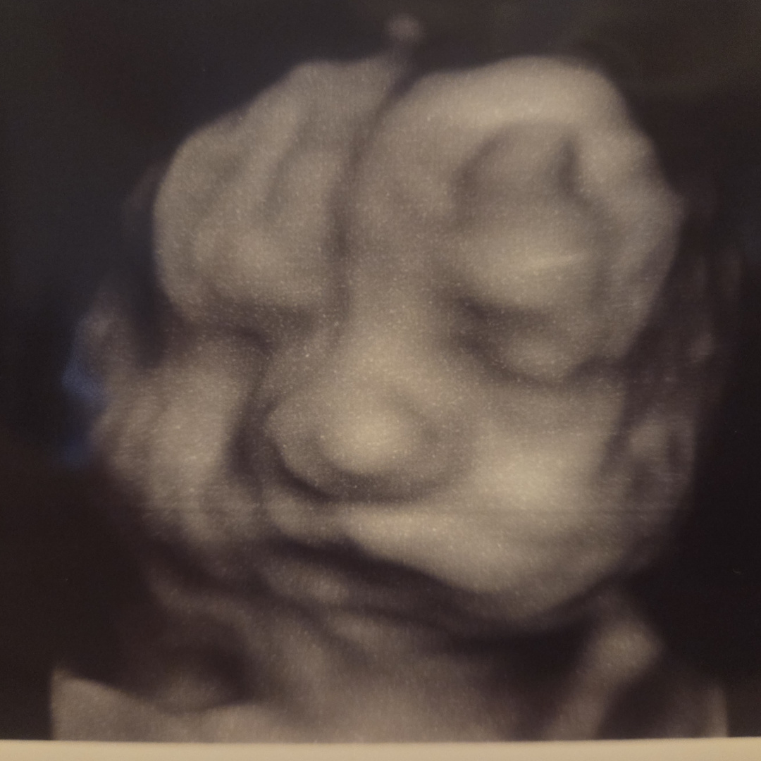Photo shared by Chelsea for their Babylist baby registry.