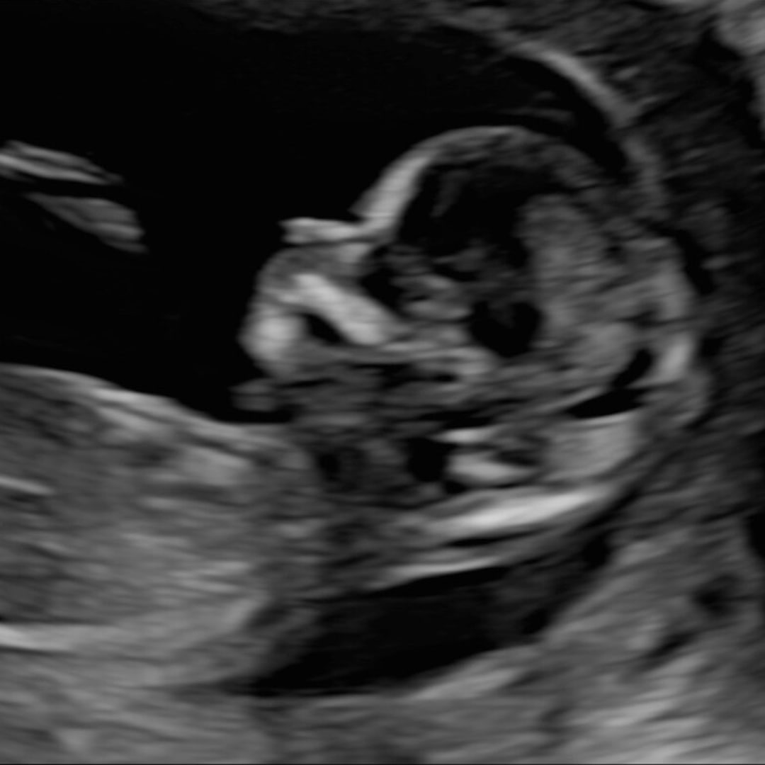 Photo shared by Ashley for their Babylist baby registry.