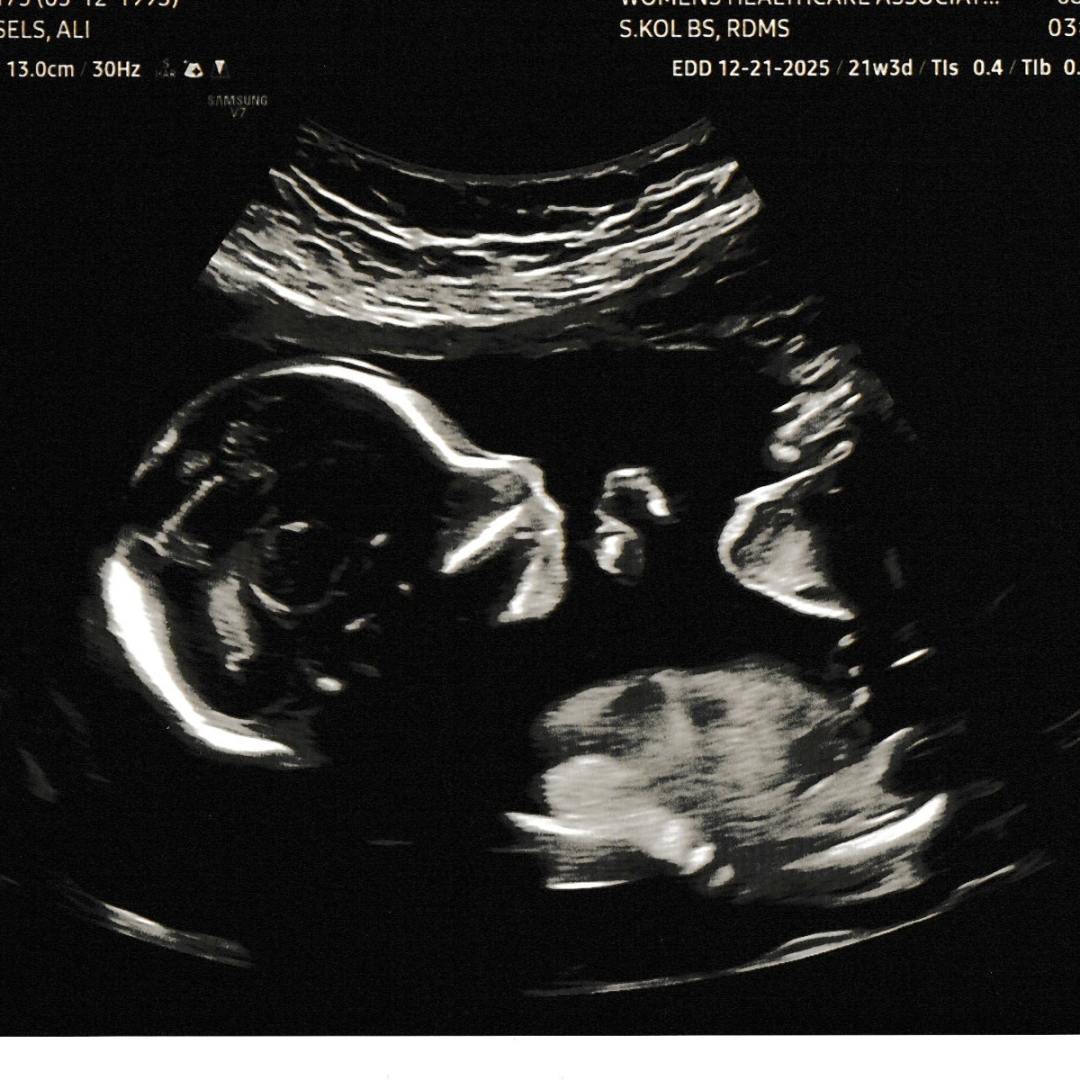 Photo shared by Ali for their Babylist baby registry.