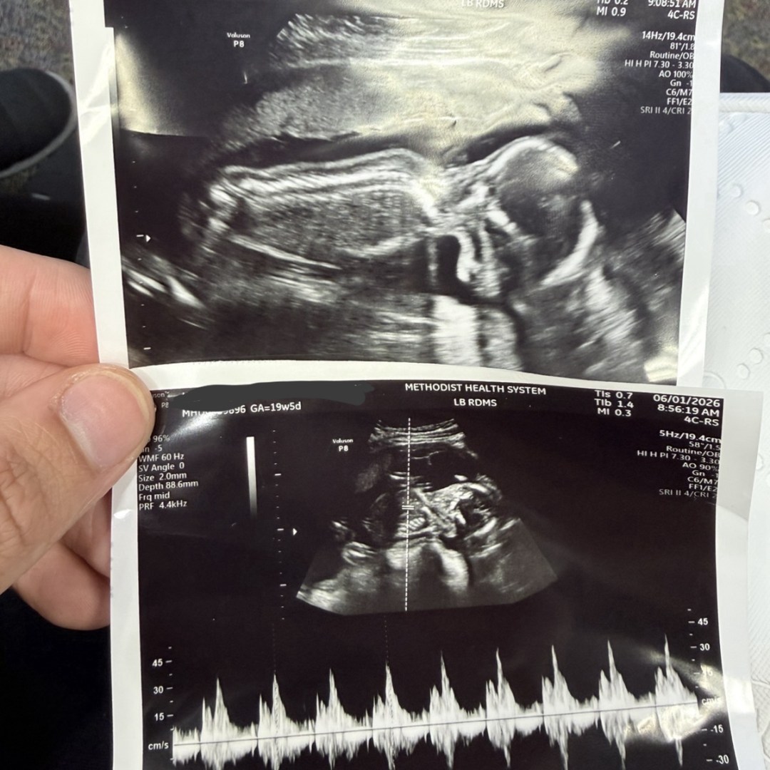Photo shared by Rachel for their Babylist baby registry.