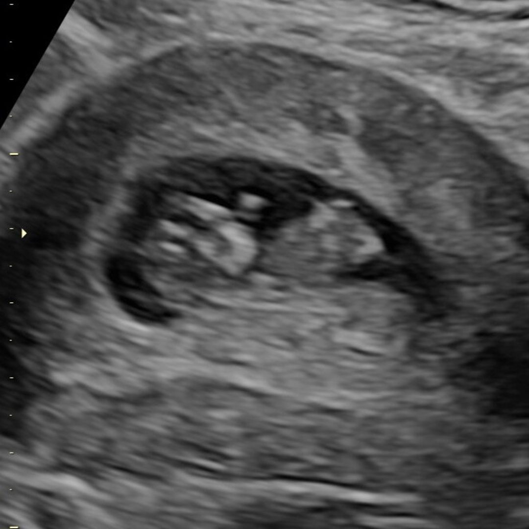 Photo shared by Danielle for their Babylist baby registry.