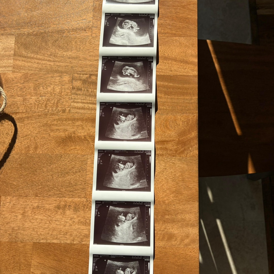 Photo shared by Joni for their Babylist baby registry.