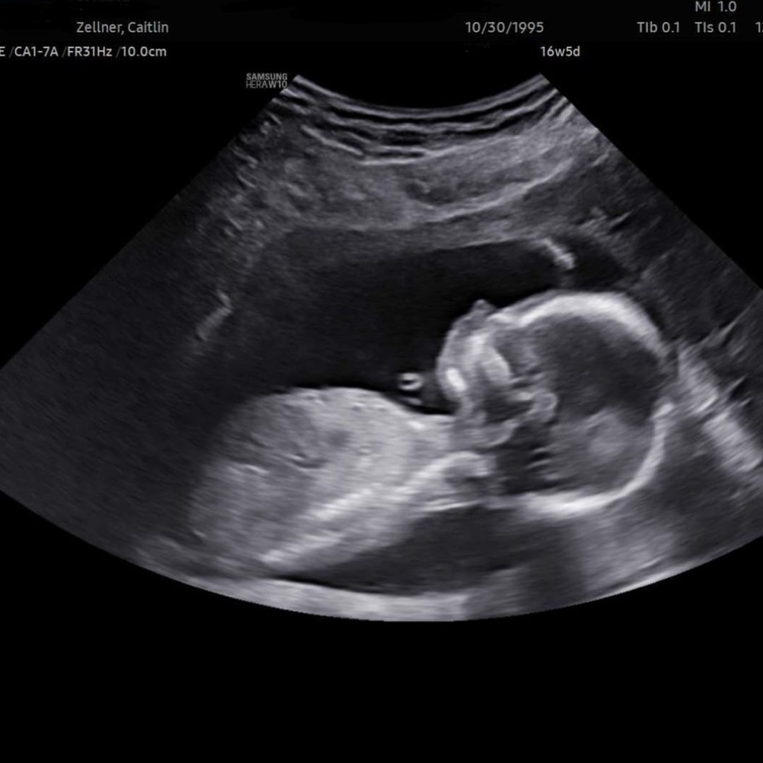 Photo shared by Caitlin for their Babylist baby registry.