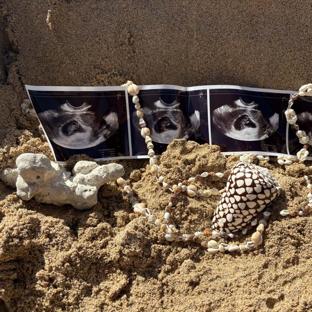 Photo shared by Carena for their Babylist baby registry.