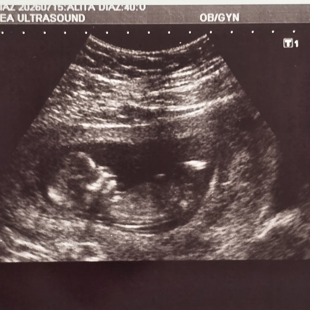 Photo shared by Alita for their Babylist baby registry.