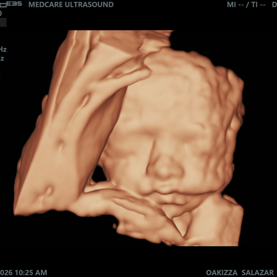 Photo shared by Oakizza for their Babylist baby registry.
