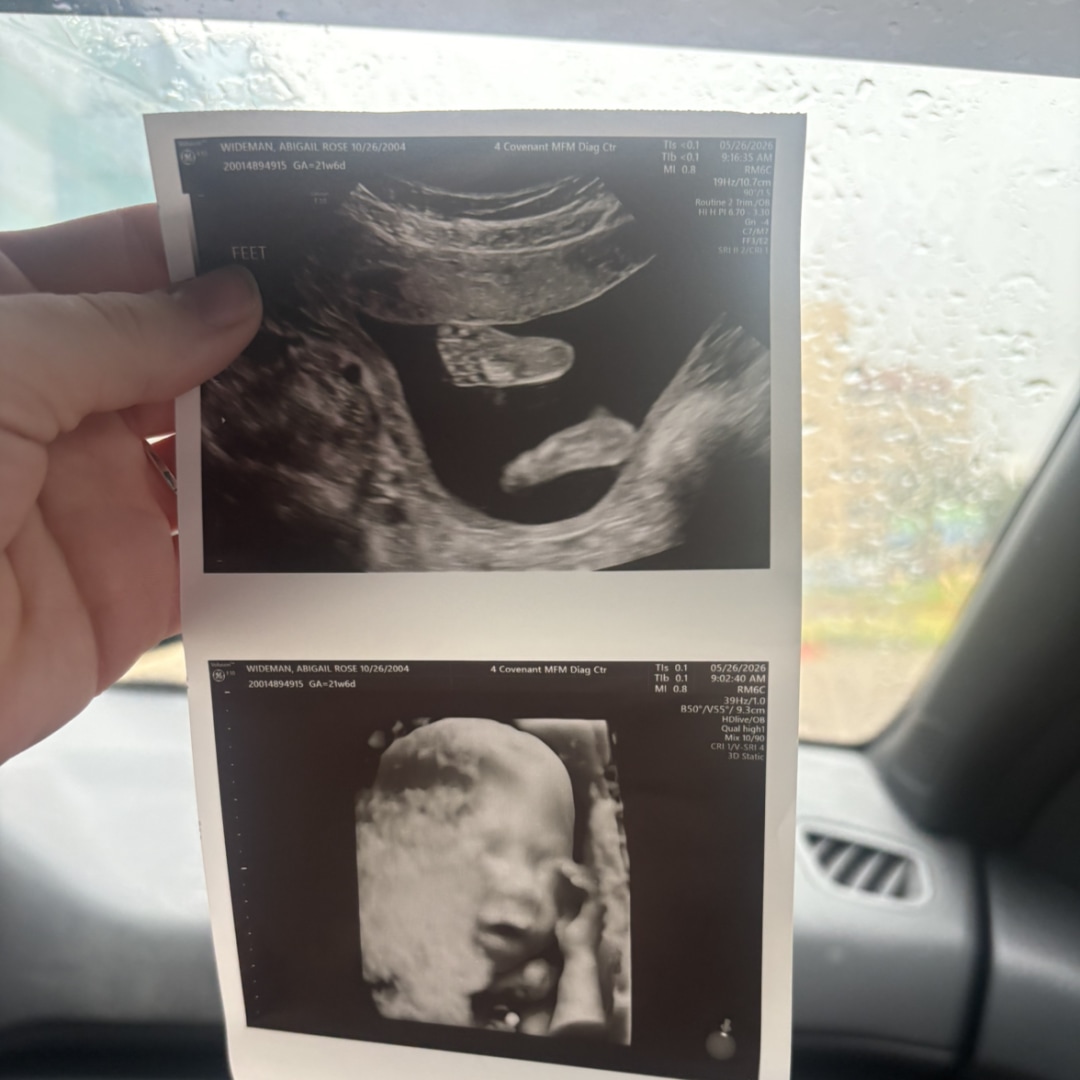 Photo shared by Abby for their Babylist baby registry.
