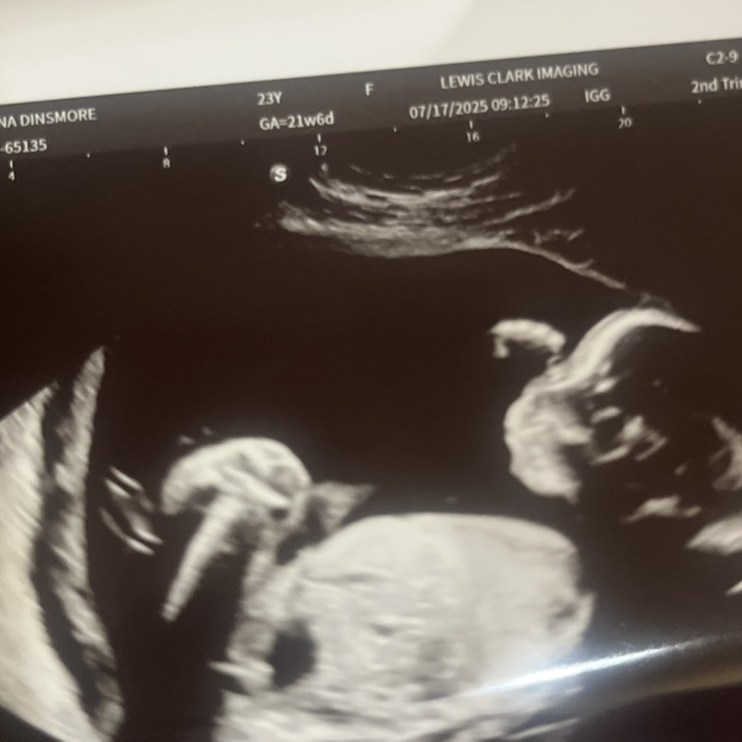 Photo shared by Anna for their Babylist baby registry.