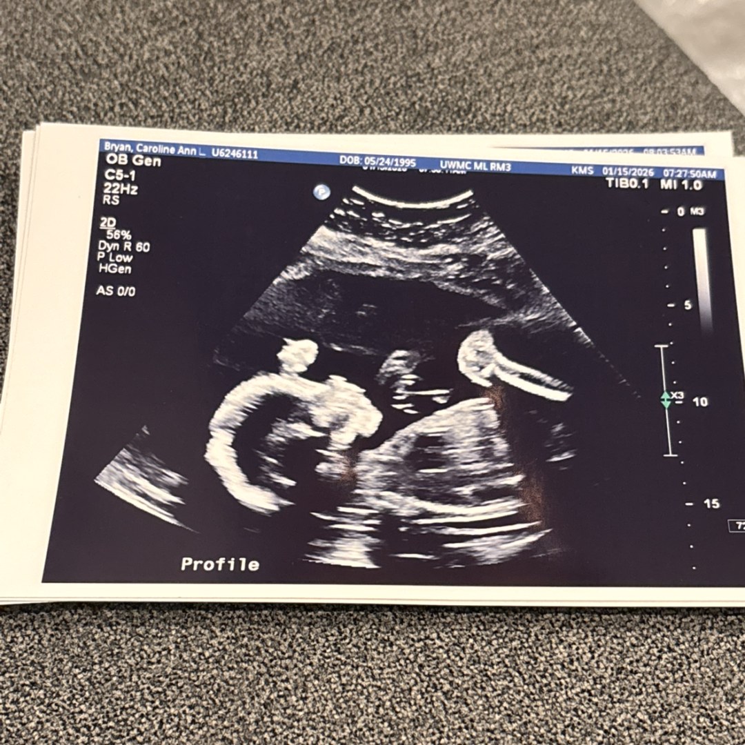 Photo shared by Caroline for their Babylist baby registry.