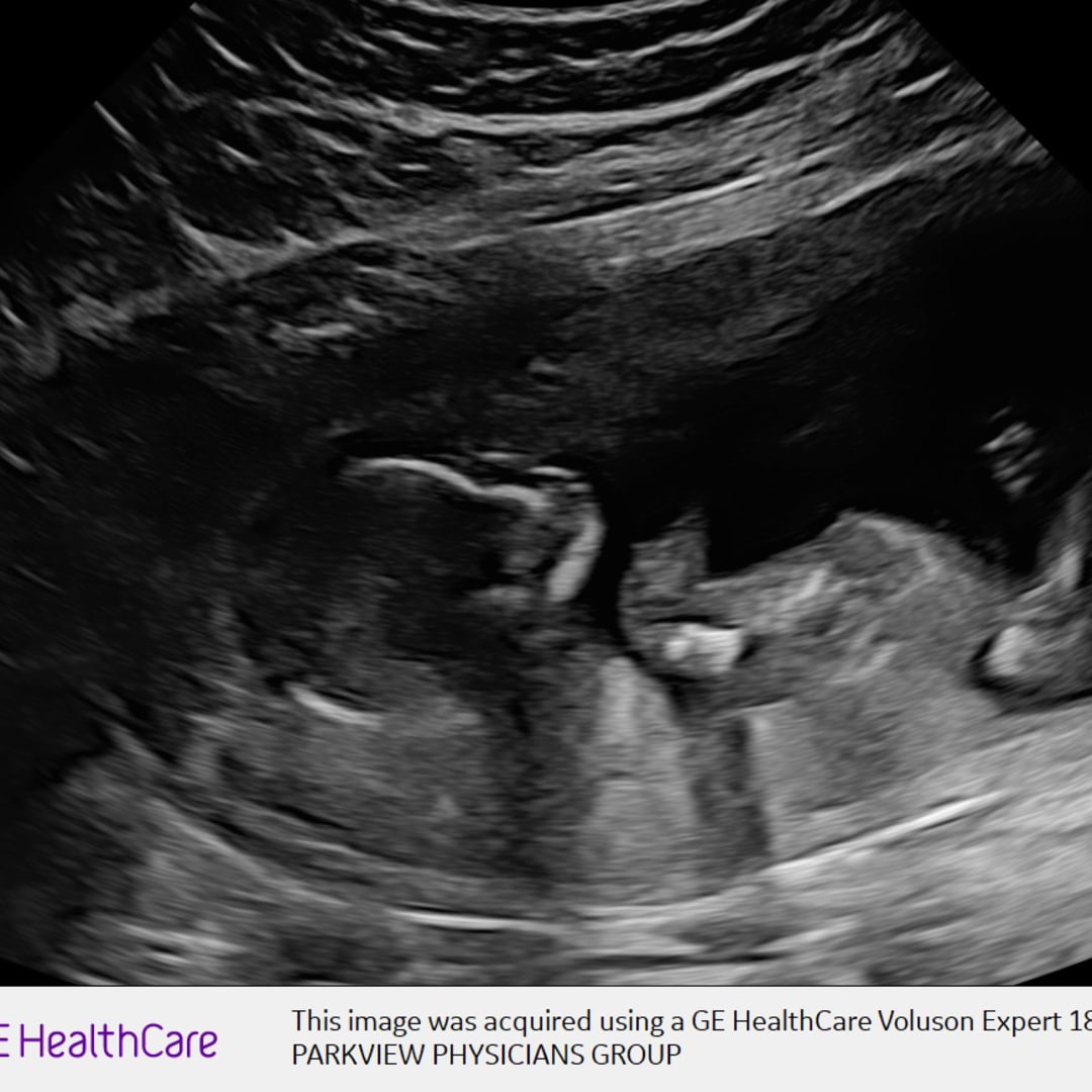 Photo shared by Audrey for their Babylist baby registry.