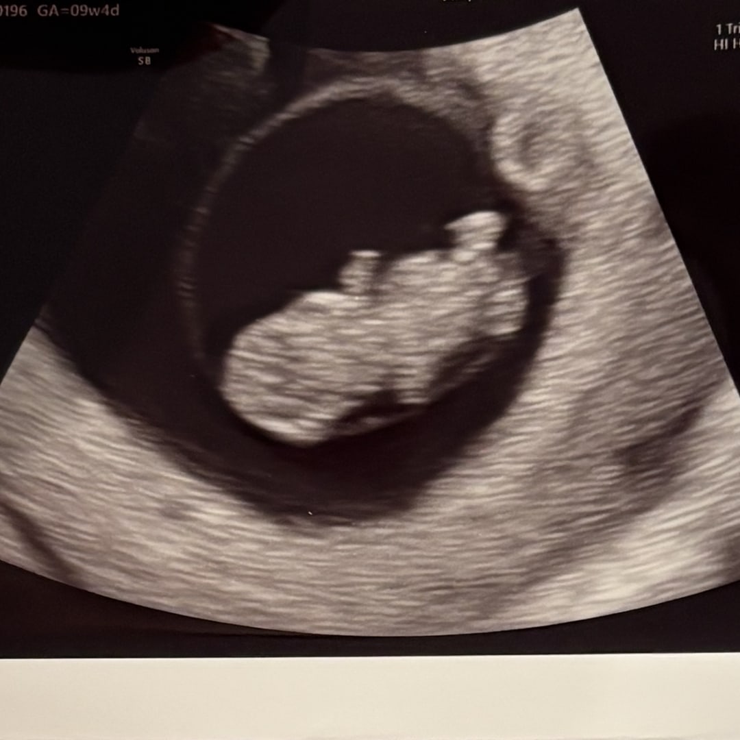 Photo shared by Ema for their Babylist baby registry.