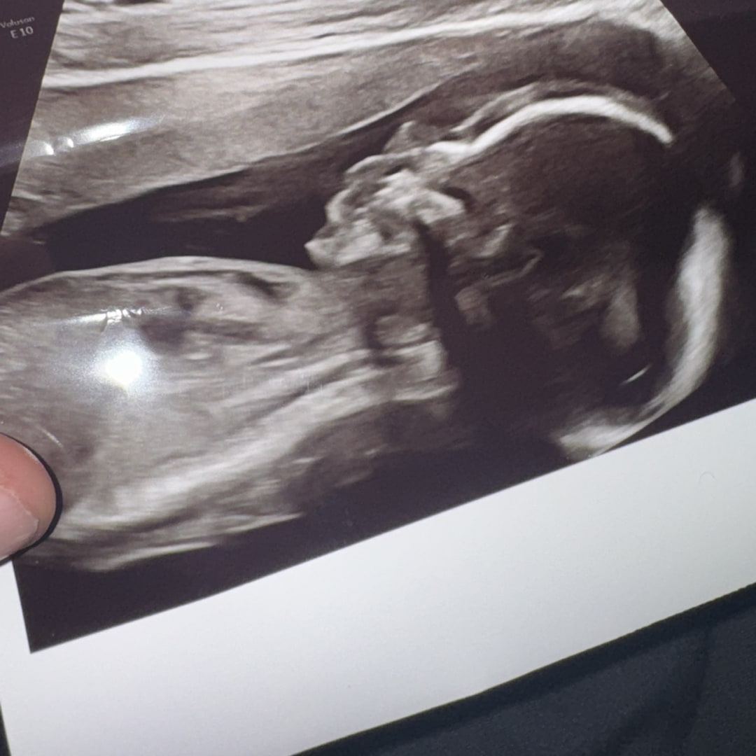 Photo shared by Gabriel for their Babylist baby registry.