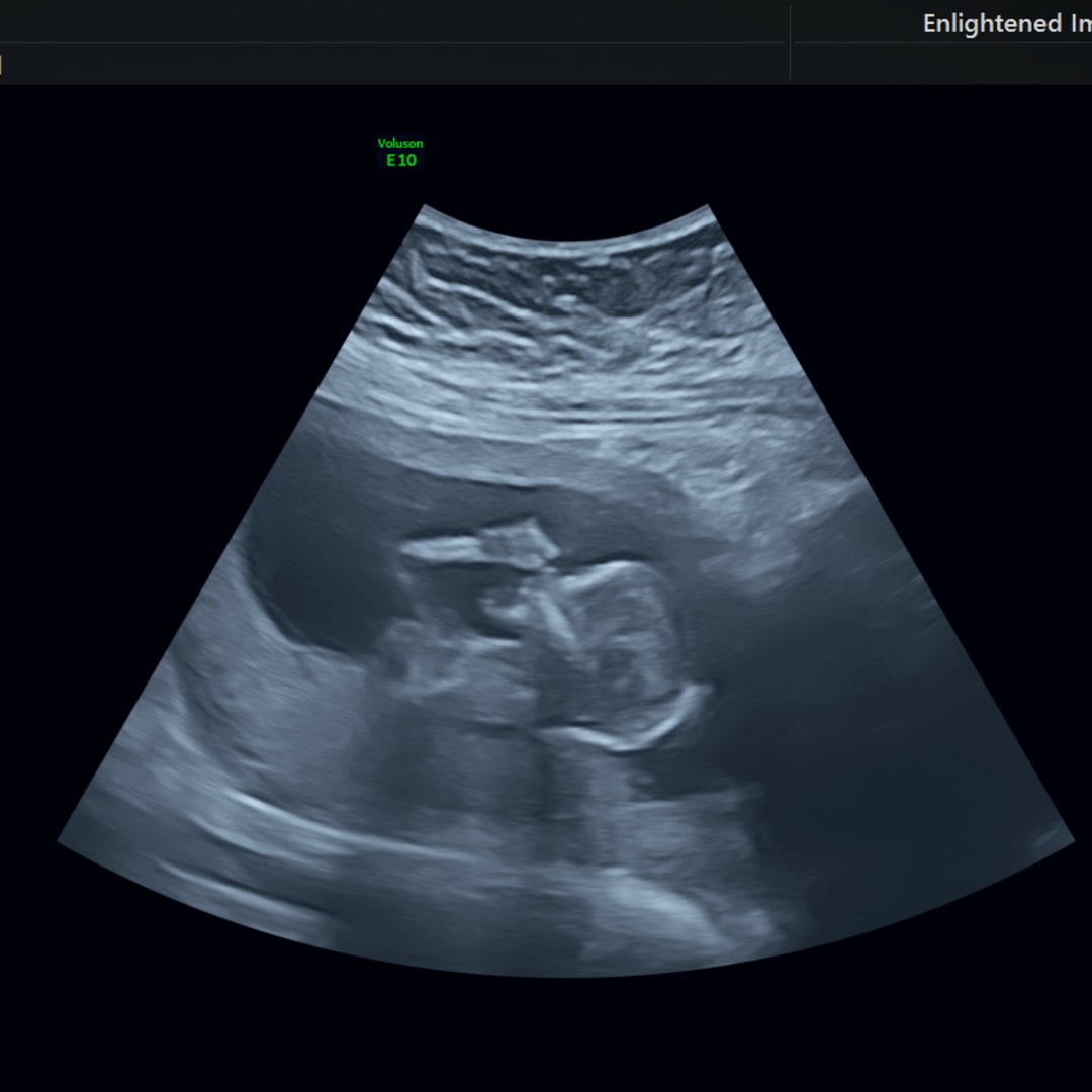 Photo shared by Ella for their Babylist baby registry.