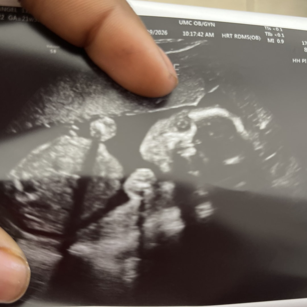 Photo shared by Angel for their Babylist baby registry.