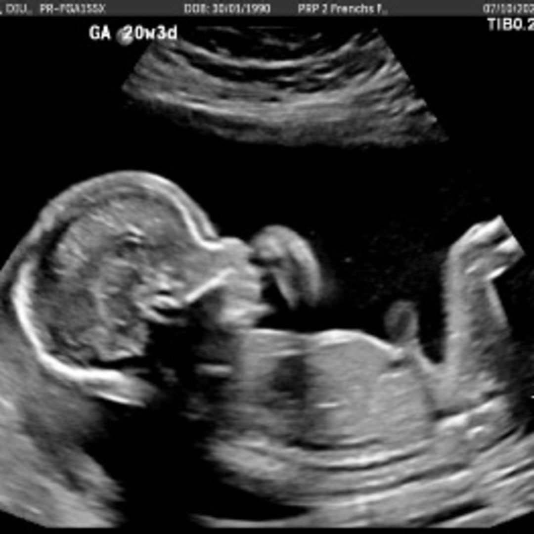Photo shared by Diully for their Babylist baby registry.