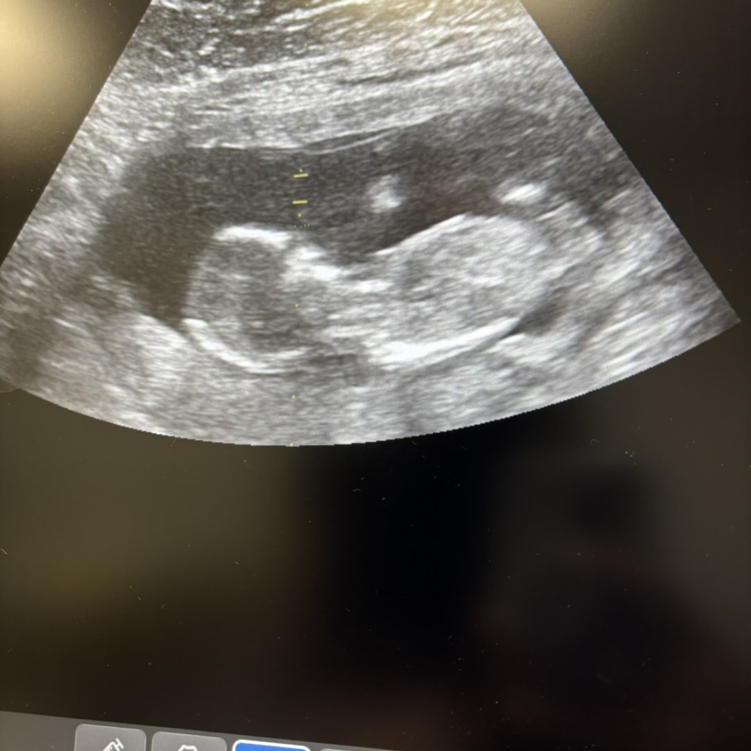 Photo shared by Tricia for their Babylist baby registry.