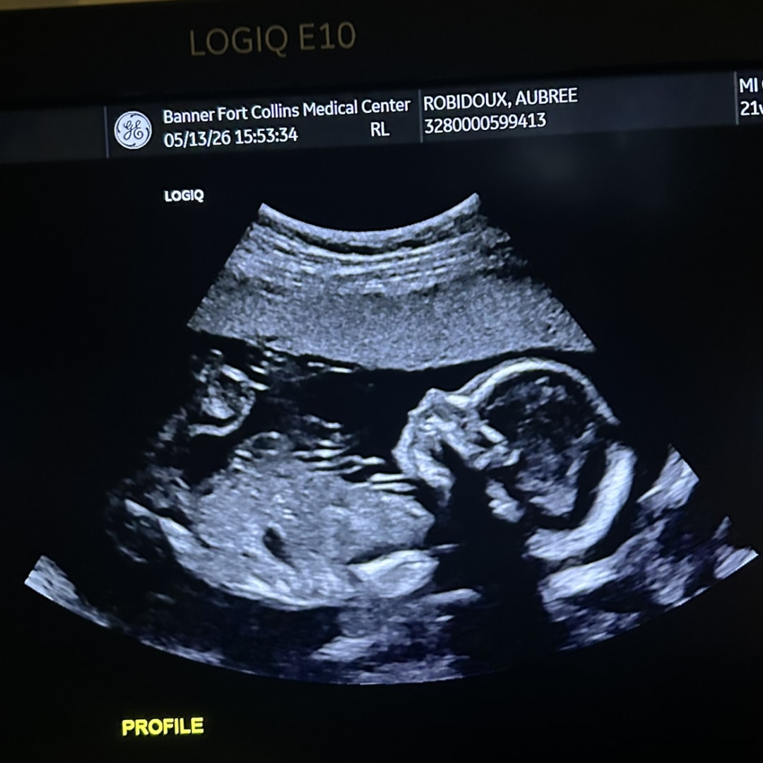 Photo shared by Aubree for their Babylist baby registry.
