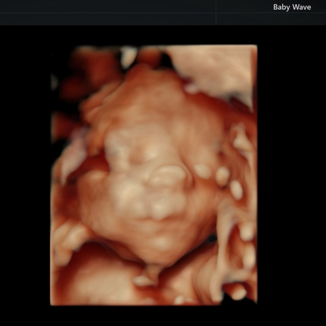 Photo shared by Renee for their Babylist baby registry.