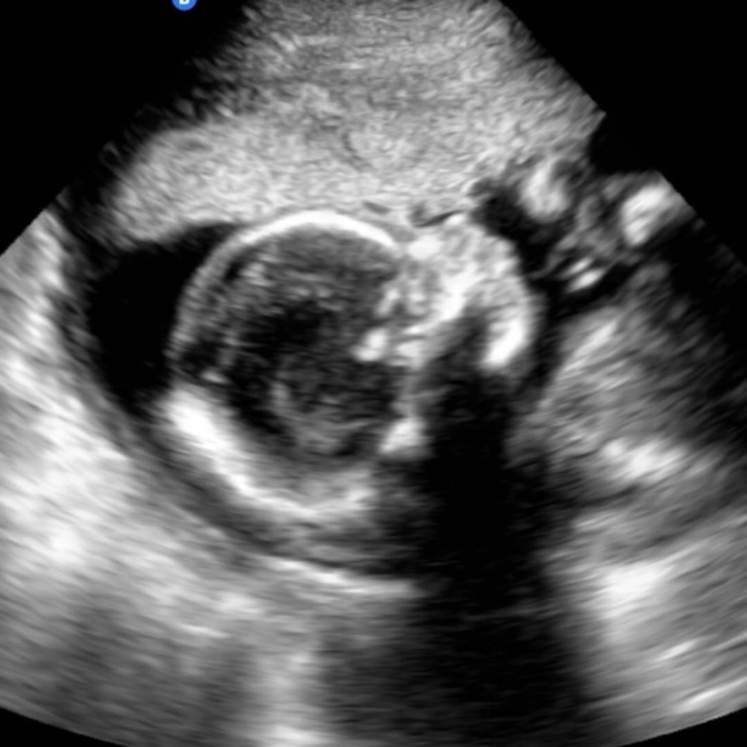Photo shared by Arika for their Babylist baby registry.