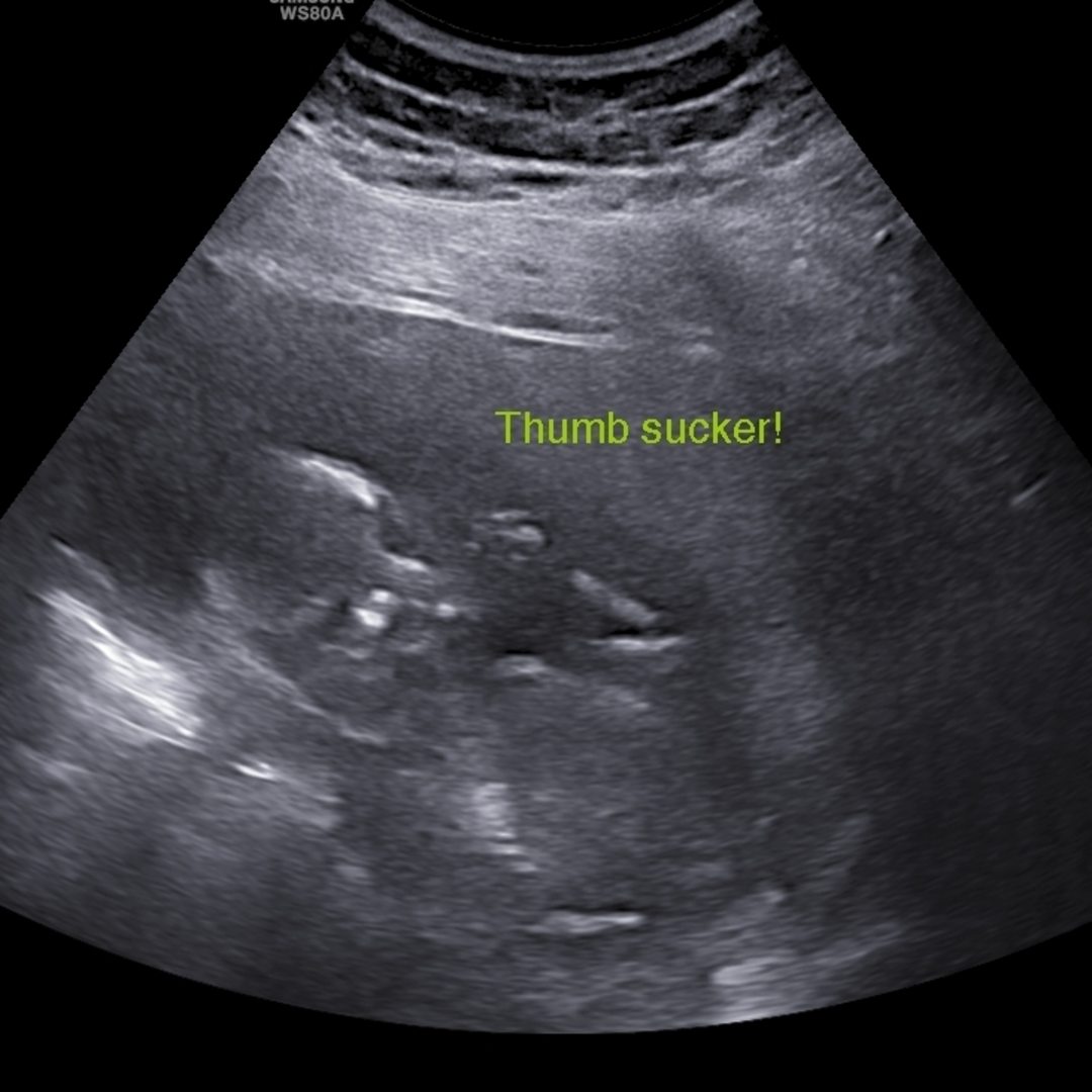 Photo shared by Ciara for their Babylist baby registry.