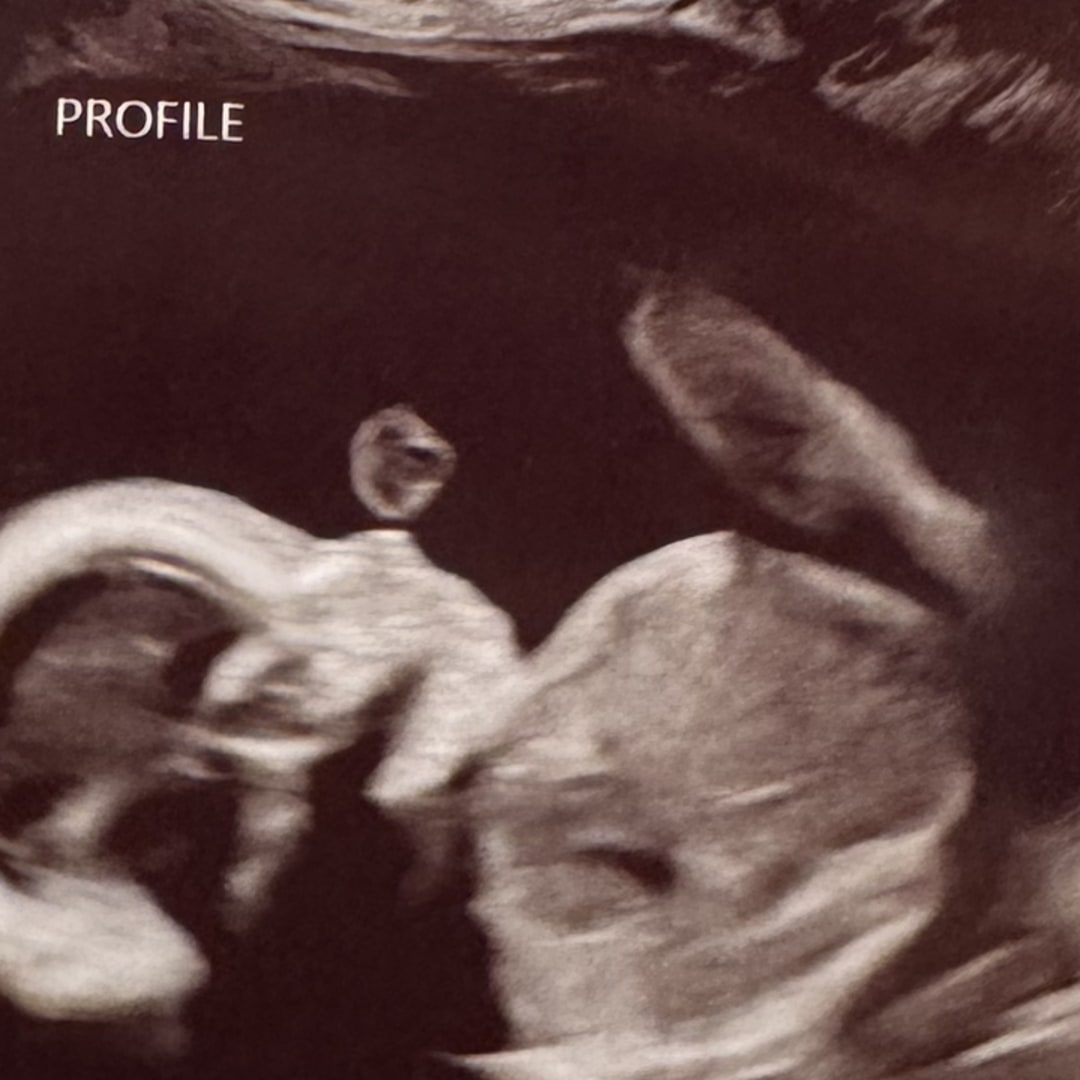 Photo shared by Elize for their Babylist baby registry.