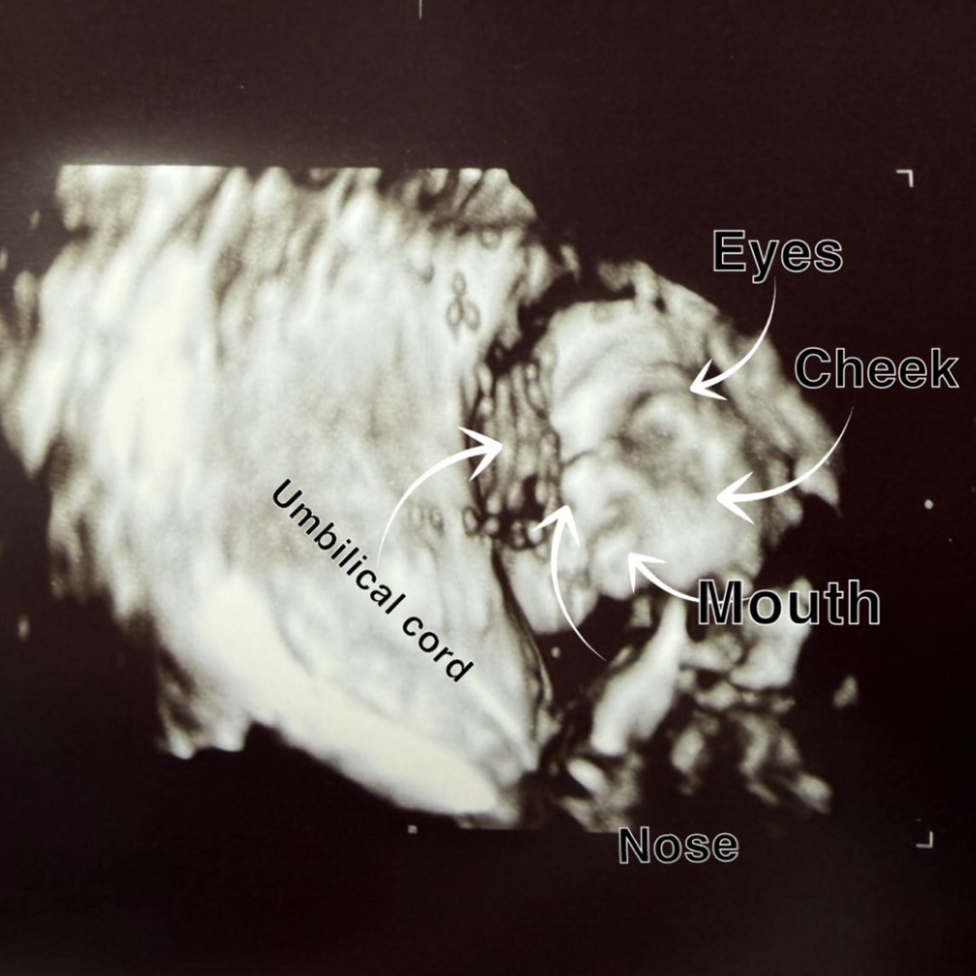 Photo shared by Hayley for their Babylist baby registry.