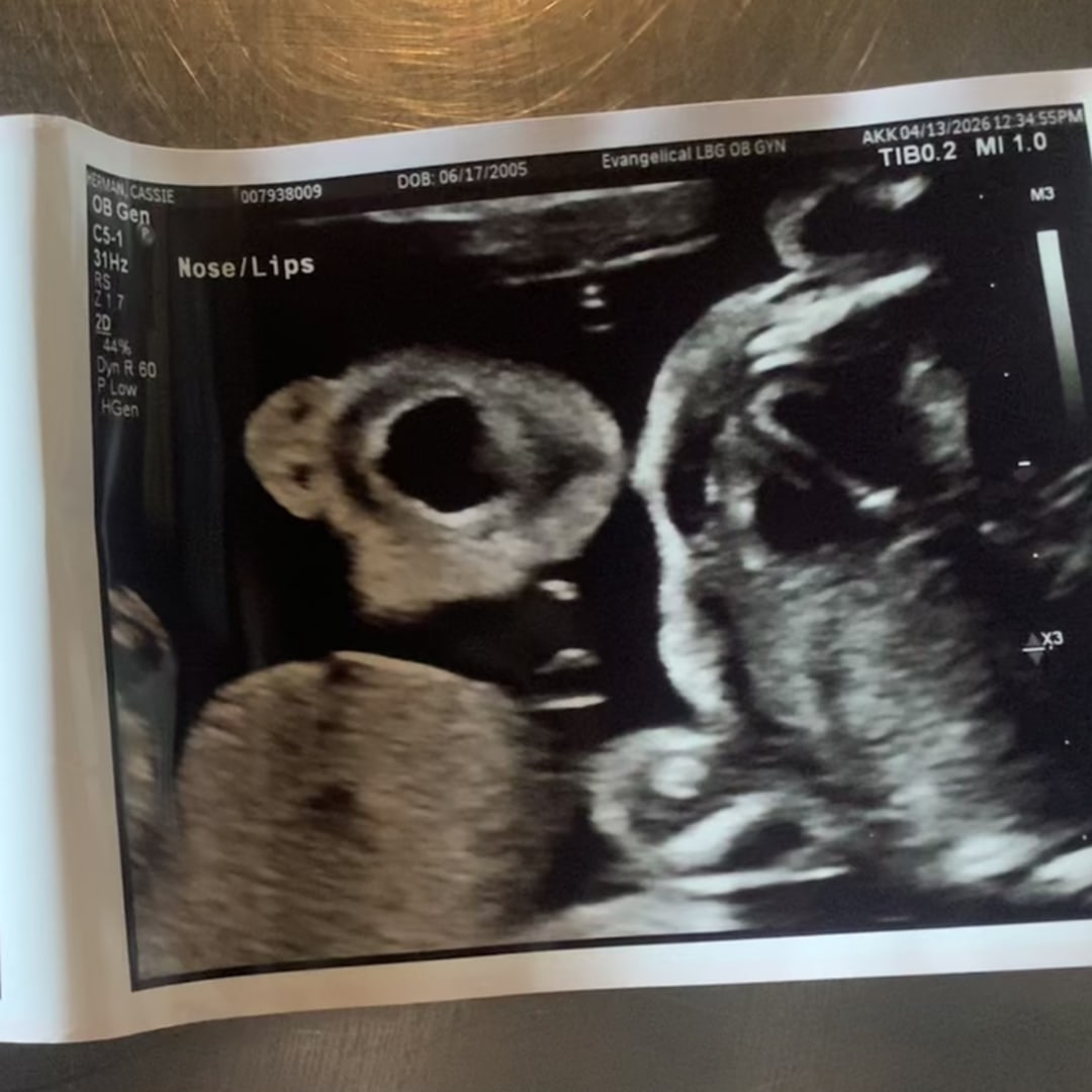 Photo shared by Cassie for their Babylist baby registry.