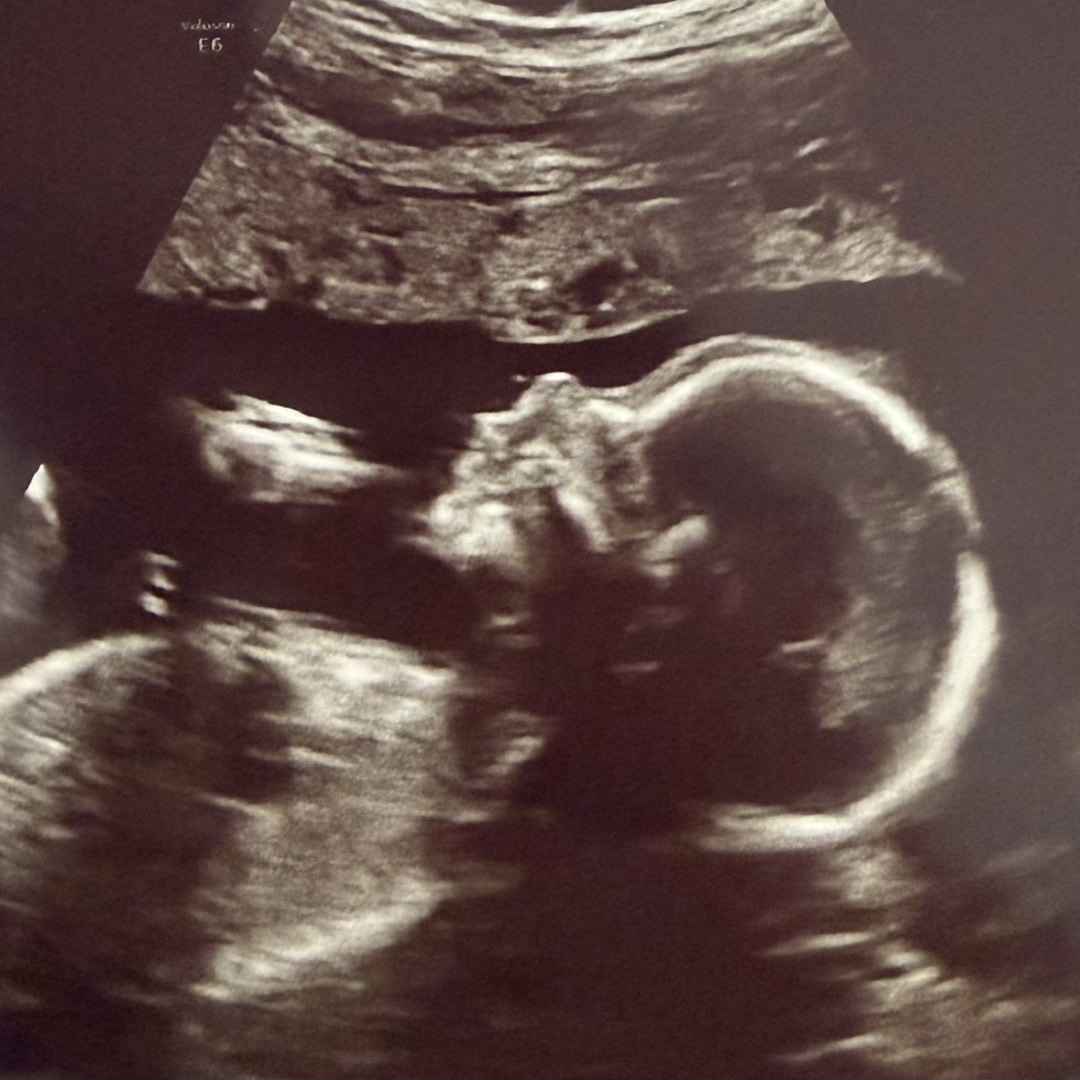 Photo shared by Alexis for their Babylist baby registry.