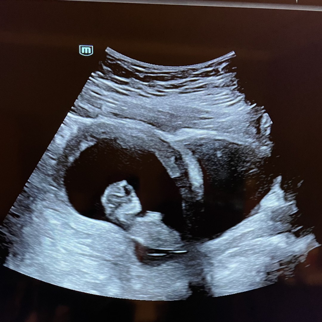 Photo shared by Abby for their Babylist baby registry.