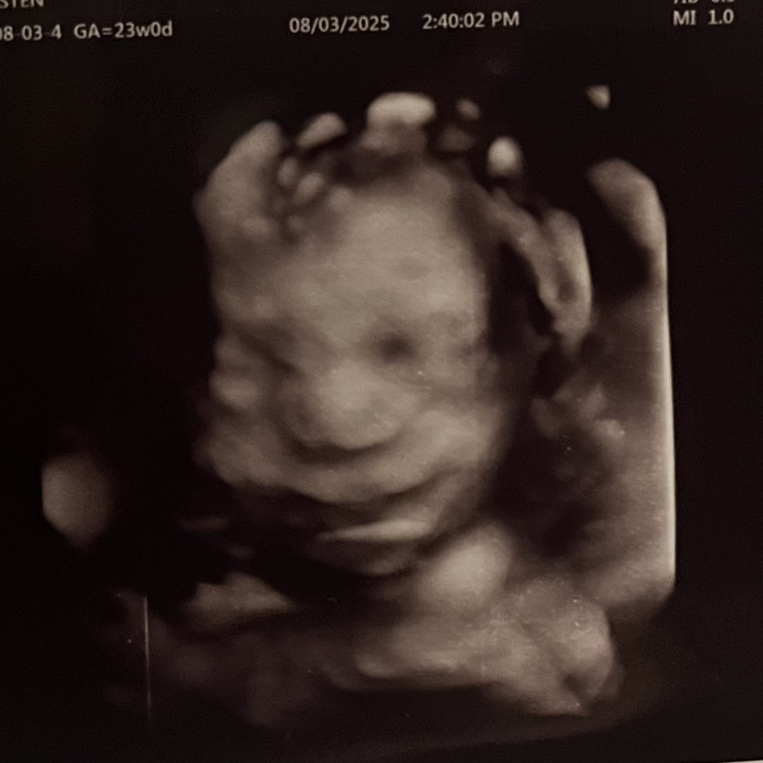 Photo shared by Kiersten for their Babylist baby registry.