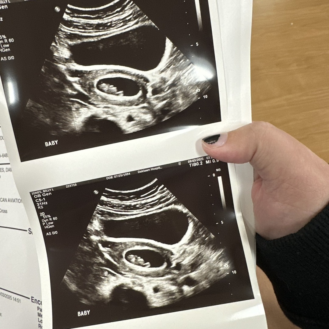 Photo shared by Billy for their Babylist baby registry.