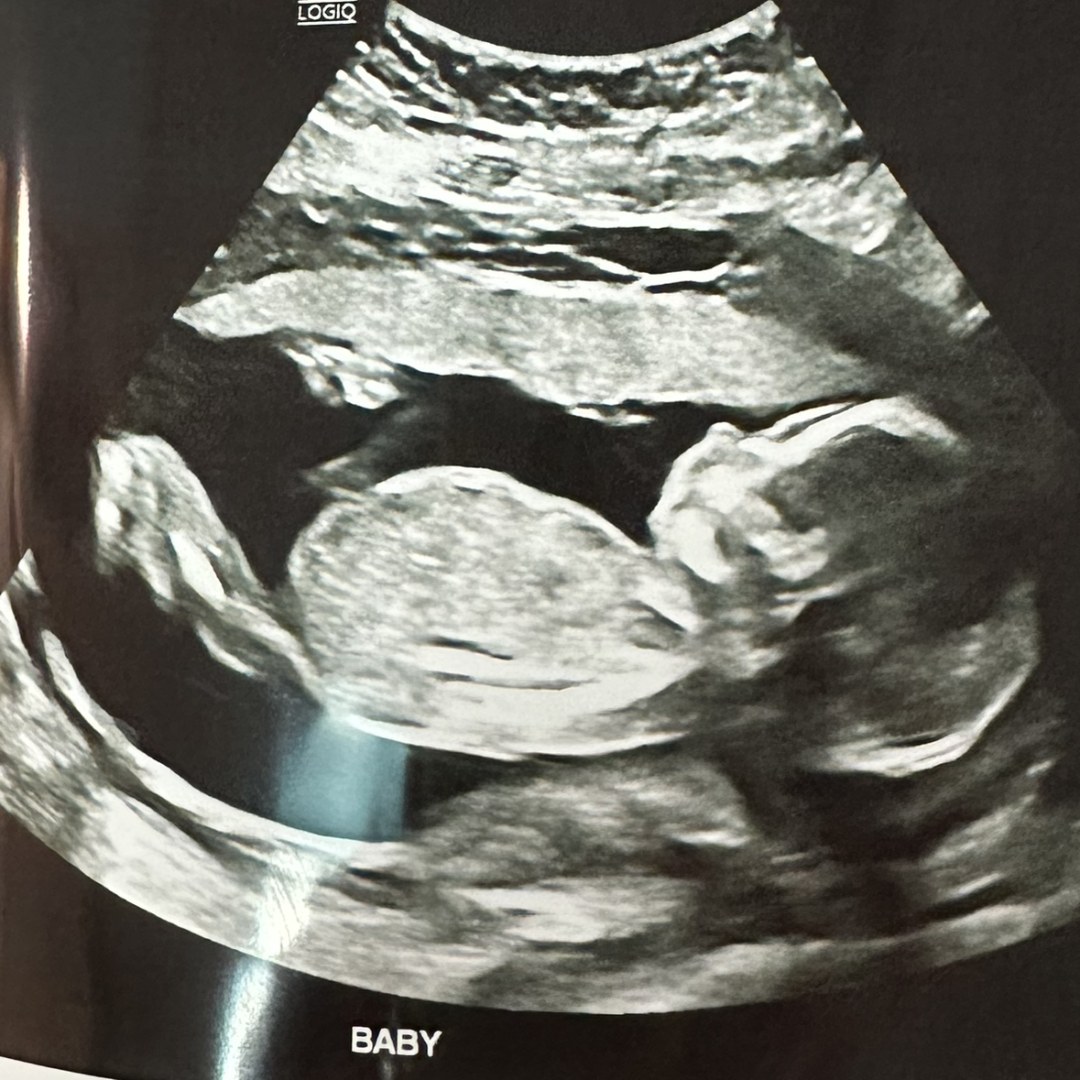 Photo shared by Alexandria for their Babylist baby registry.